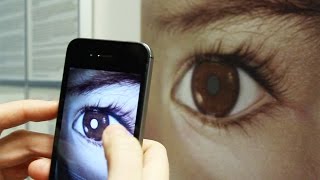 Detect Eye Cancer Retinoblastoma with Your Smart Phone – CHECT UK [upl. by Iralam396]