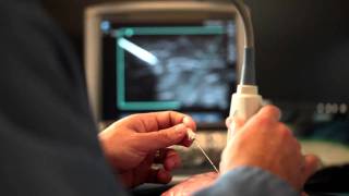 Advanced Needle Visualization for Primary Care  SonoSite Ultrasound [upl. by Muhan]