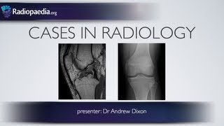 Cases in Radiology Episode 4 musculoskeletal MRI xray [upl. by Redmer716]