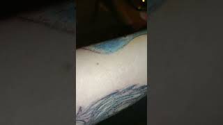 Neatcell Blue light Laser Pen Review and Update on Tattoo Removal [upl. by Idleman164]