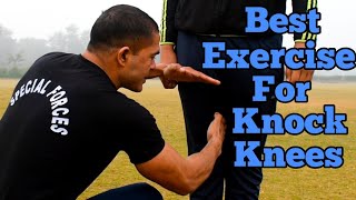 Knock Knees दूर करे With Commando  Commando Fitness Club [upl. by Wilkinson]