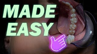 Dental Photography Techniques  Canon Nikon Sony  ULTIMATE GUIDE 2021  Part 3 [upl. by Mccreery]