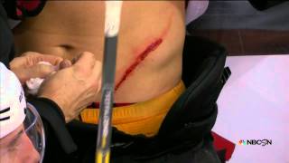 Brayden Schenn gets cut on stomach by skate [upl. by Amaryl295]