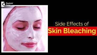 What are the side effects of bleaching your skin  Dr Aruna Prasad [upl. by Nuarb]