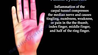 Anatomy of Carpal Tunnel Syndrome  Everything You Need To Know  Dr Nabil Ebraheim [upl. by Dart14]