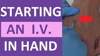 How to Start an IV  IV Catheter Insertion amp Flush Technique in Hand  Nursing Skill [upl. by Lamonica919]