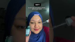 Serum That Clear Acne Without Purging Clear Skin Secrets skincareproduct [upl. by Raynell448]