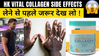 HK VITAL COLLAGEN REVIEWSIDE EFFECTS 😥  HK VITAL COLLAGEN Results 🔥  लेने से पहले देख लो [upl. by Ymma]