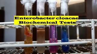 Enterobacter cloacae Biochemical tests Demonstration [upl. by Anelet]