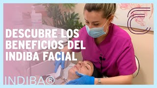 Tratamiento FACIAL INDIBA® en Valencia [upl. by Enajharas]