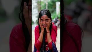 acid attack reels  real Story  reels [upl. by Turino]