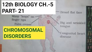 Class 12 biology chapter 5part 21chromosomal disordersby study with Farru [upl. by Yevol]