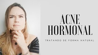 ACNE HORMONAL  COMO TRATAR DE FORMA NATURAL [upl. by Euseibbob]