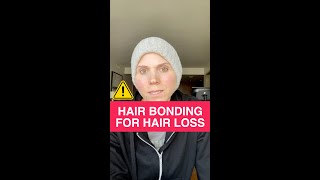 Hair Bonding Hair Replacement For Hair Loss  The Truth [upl. by Etnuad]