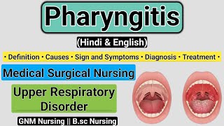 Pharyngitis Definition Causes Signs and symptoms Diagnosis Treatment  Pharyngitis In Hindi [upl. by Eugor7]