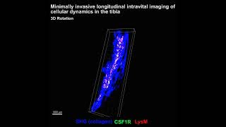 New imaging method reveals activity of cells that break down bone [upl. by Gigi]