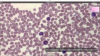 What blood looks like down the microscope [upl. by Eseenaj]