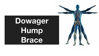 Dowager Hump Brace [upl. by Petit]