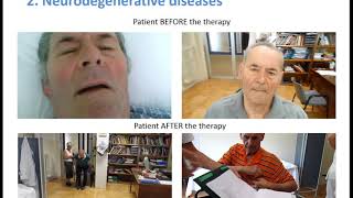 High Dose Thiamine Therapy short [upl. by Quiteri]