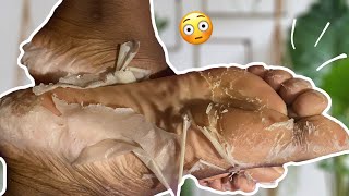 CASH TEST PEELING PIEDS  Le fameux masque « peau de serpent » [upl. by Pren]