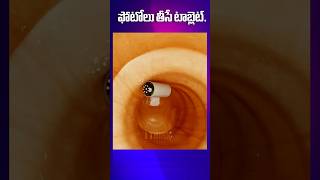 ఫోటోలు తీసే టాబ్లెట్ Capsule Endoscopy  I Think [upl. by Lav]