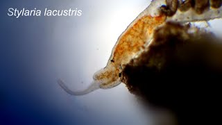 Stylaria lacustris under the microscope [upl. by Eissirc]