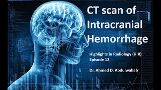 CT of intracranial hemorrhage Highlights in Radiology HIR episode 12 [upl. by Mulcahy265]