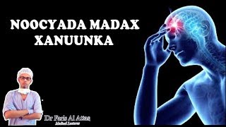 MADAXA MA KU XANUUNAA  Noocyada Madax Xanuunka iyo Sida loo Daaweyo  Dr faris [upl. by Orodisi460]