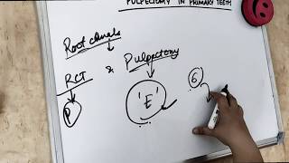 pulpectomy procedure in primary teeth special rct [upl. by Sunday]