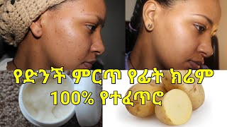 የጠቋቆሩና የሞተ ቆዳን በፍጥነት የሚያነሳ ልዩ የተፍጥሮ የድንች ክሬም [upl. by Lessig]