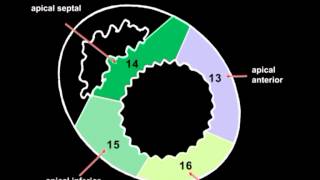 Volodymyr Pavliuk MD PhD Echocardiographic Assesment of Left Ventricular Systolic Function [upl. by Crescantia]