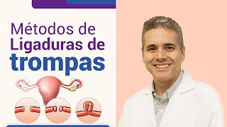 Métodos de ligadura de trompas l Dr Juan Luis Giraldo [upl. by Male]