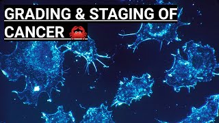 What is Cancer Grading amp Staging  Basic Information [upl. by Eanal375]