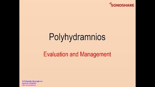 OBSTETRICS  POLYHYDRAMNIOS [upl. by Neff588]