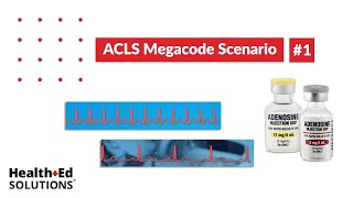 ACLS Megacode Scenario 1 Supraventricular Tachycardia SVT [upl. by Falcone491]