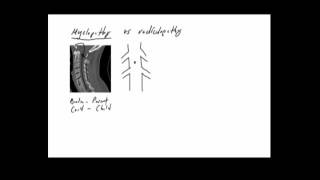 Myelopathy versus Radiculopathy [upl. by Ratib]