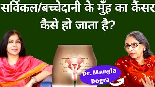 Cervical Cancerबच्चेदानी के मुँह के कैंसर के बारे में पूरी जानकारी कैसे होता है कैसे बच सकते हैं [upl. by Selfridge]