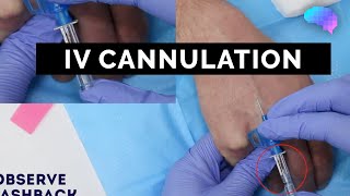 Intravenous IV cannulation  OSCE Guide  UKMLA  CPSA [upl. by Repip]