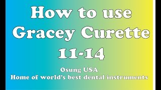 How to use Gracey Curette 1114 [upl. by Arvin]