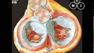 Animated Mitral Regurgitation Murmur [upl. by Akeemahs]