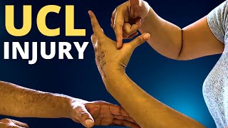 Ulnar Collateral Ligament UCL Thumb Injury Assessment amp Precautions [upl. by Suriaj]