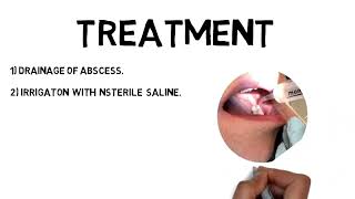 Pericoronitis Treatment  Clinical features amp Complications [upl. by Junji]