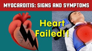 Myocarditis Symptoms and Treatment Options myocarditis myocardialinfarction [upl. by Egidius]