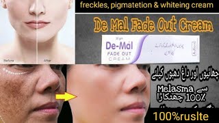 Demal fade out melasma cream ll best for pigmatetion freckles removal cream amp whitening cream [upl. by Nnuahs]