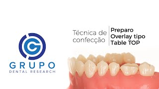 Preparo dental de Onlay tipo quotTable TOPquot  Passo a passo [upl. by Grimes]