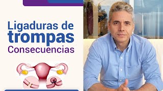 Consecuencias de la ligadura de trompas l Dr Juan Luis Giraldo [upl. by Greenquist]