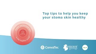 Top tips for maintaining healthy peristomal skin [upl. by Aciamaj972]