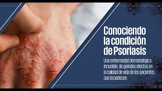 ¿Qué es la psoriasis [upl. by Blanc]