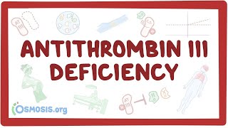 Antithrombin Deficiency Symptoms and Causes  Diagnosis  Treatment  Prevention [upl. by Baskett]