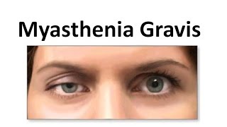 Myasthenia Gravis [upl. by Fermin]